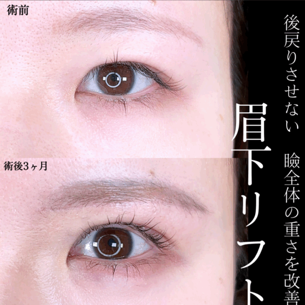 No.15769の症例写真